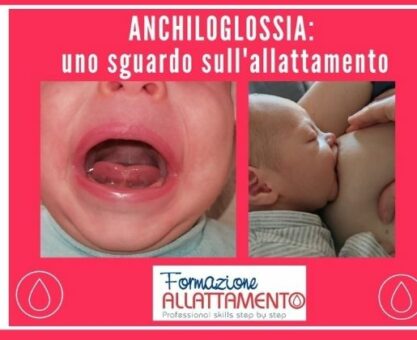 frenulo corto anchiloglossia allattamento