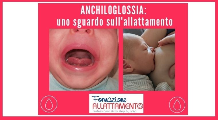 frenulo corto anchiloglossia allattamento